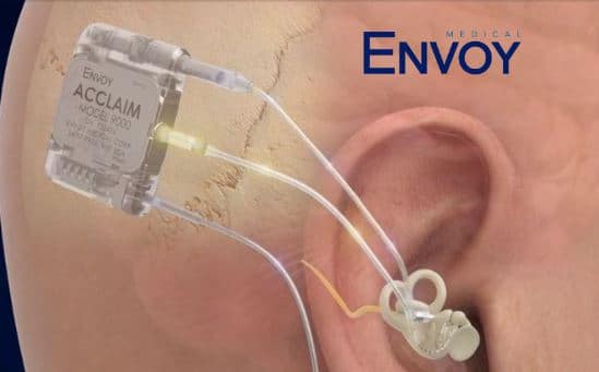 Envoy Medical Receives FDA Breakthrough Device Designation for its Fully Implanted Acclaim® Cochlear Implant