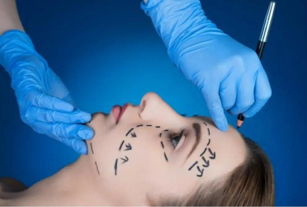 How to Prepare Yourself for a Facelift Surgery 1 Facelift Surgery