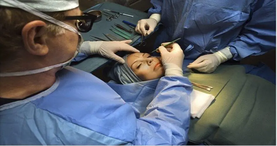 How to Prepare Yourself for a Facelift Surgery 2 Facelift Surgery