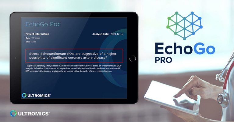 EchoGo Pro Receives FDA Clearance Is Now Available to Physicians in the U.S.: 1st of Kind Solution in Echocardiography