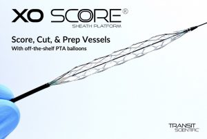 Transit Scientific, XO Score