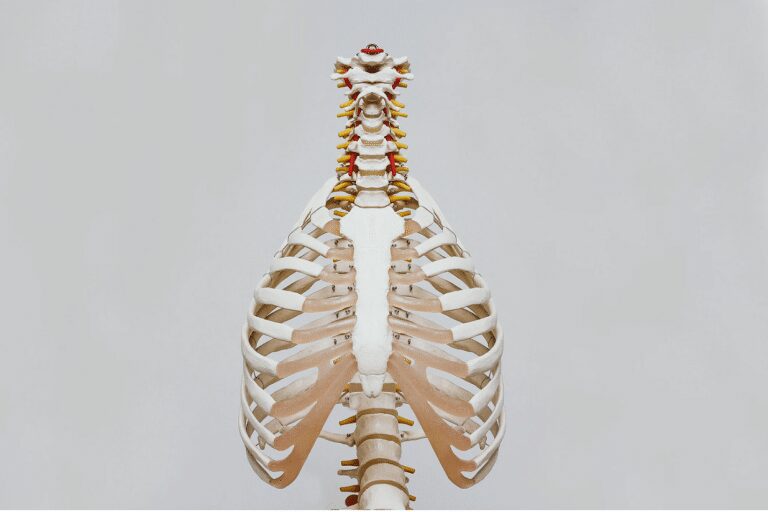 Spine Injury: Dissecting Auto Accident Injuries