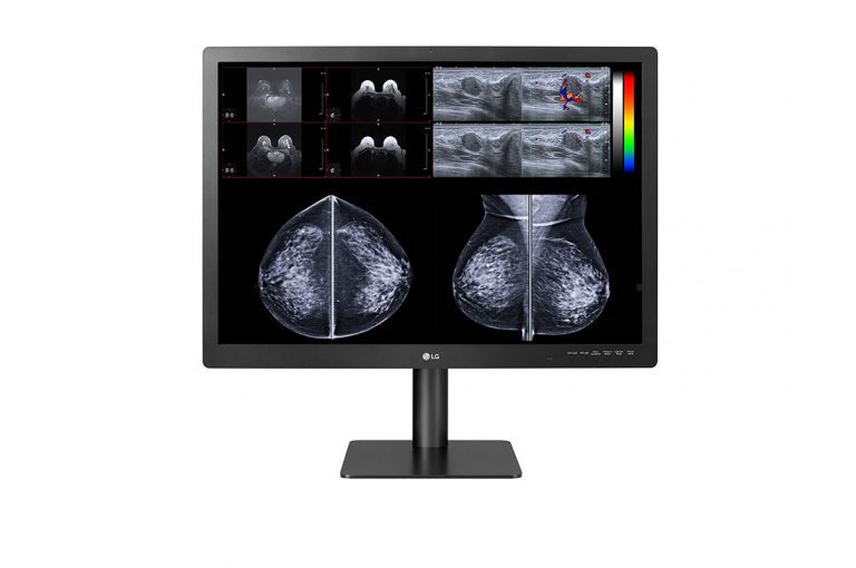 LG Expands Diagnostic Medical Monitor Line with New 12-Megapixel Multimodality Display