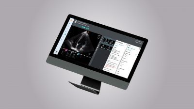 EchoNous Secures $60 Million in Funding from Kennedy Lewis Investment Management