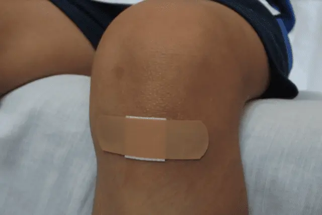 Bites And Stings: How To Make Sure Your Bite Wound Is Not Infected 1 Bites And Stings: How To Make Sure Your Bite Wound Is Not Infected