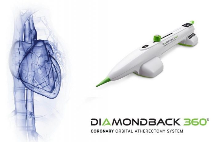 First Patients in Canada Treated With Cardiovascular Systems, Inc. Diamondback 360® Coronary Orbital Atherectomy System