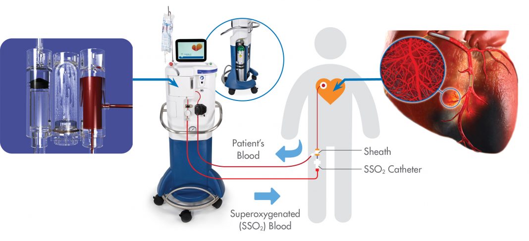 New Category III CPT Code for TherOx SSO2 Therapy (ZOLL Medical)