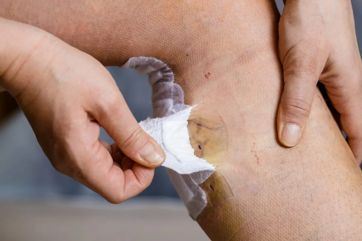 9 Surgical Aftercare Tips To Maximize Recovery 1 Surgical Aftercare Tips to know