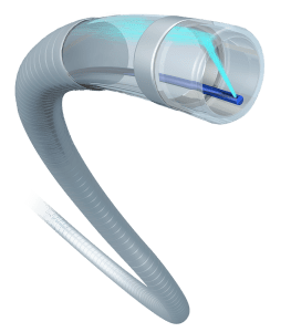 Abbott Expands Peripheral Vascular Offerings with Acquisition of Walk Vascular, LLC
