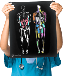 News AMRA Medical's Whole-body MRI Analysis Used in FSHD Clinical Trial Research Network Study for Biomarker Development