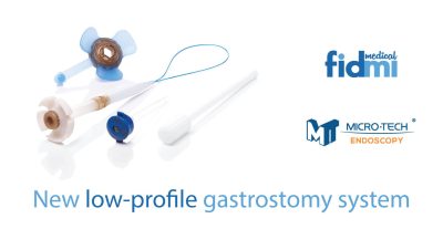 News Fidmi Medical Launches U.S. Sales of Novel Low-Profile PEG Device and Raises $2.2 Million
