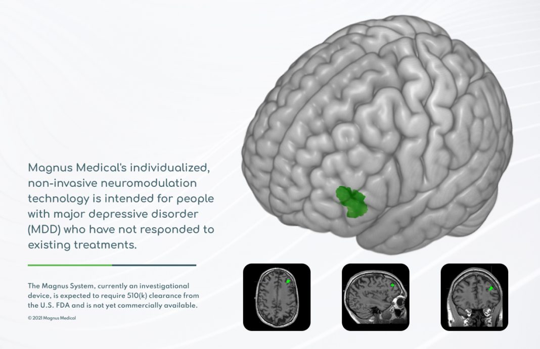 Magnus Medical Launches With Breakthrough Device Designation for Rapid, Individualized Treatment of Major Depression and $25M in Series A Financing News reported by Medical Deice News Magazine