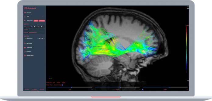 Advantis Medical Imaging Receives FDA Clearance for Brain MRI Analysis Software