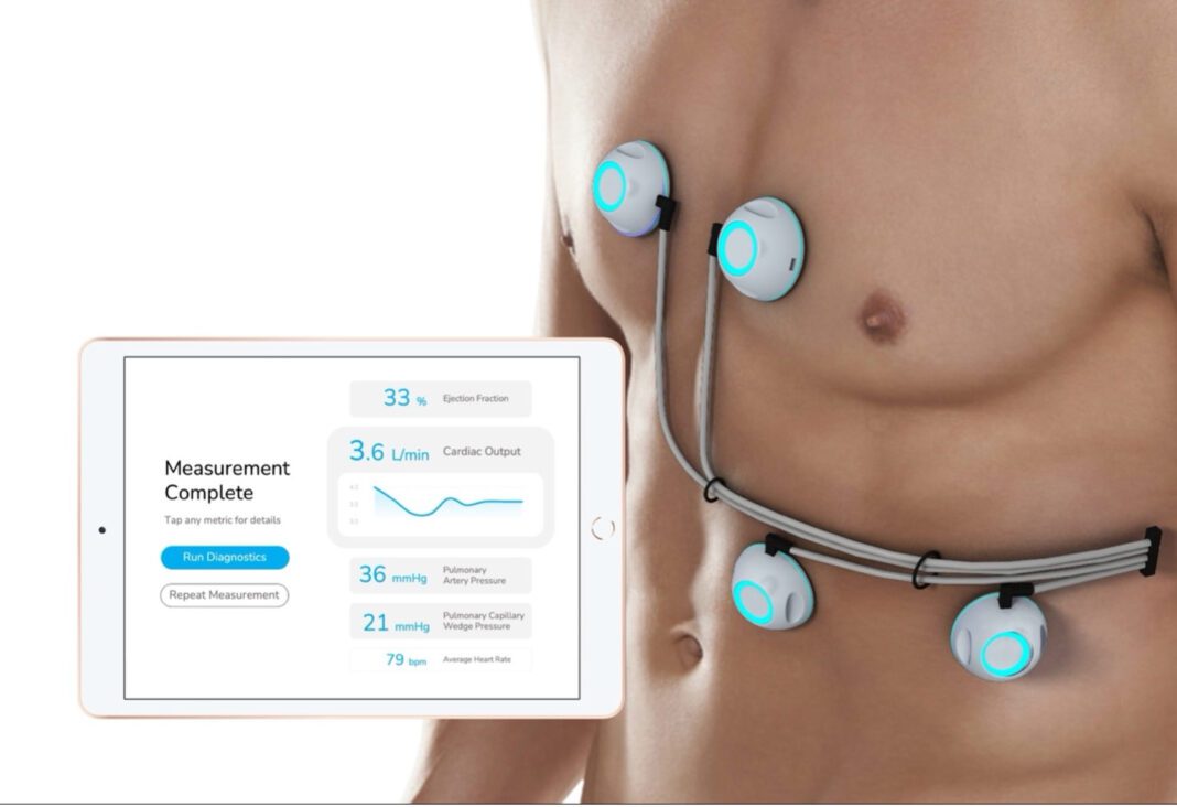 Cardiac Performance System