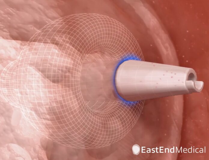 East End Medical Announces 1st Commercial Use of its Novel All-in-One SafeCross™ Transseptal RF Puncture and Steerable Balloon Introducer System