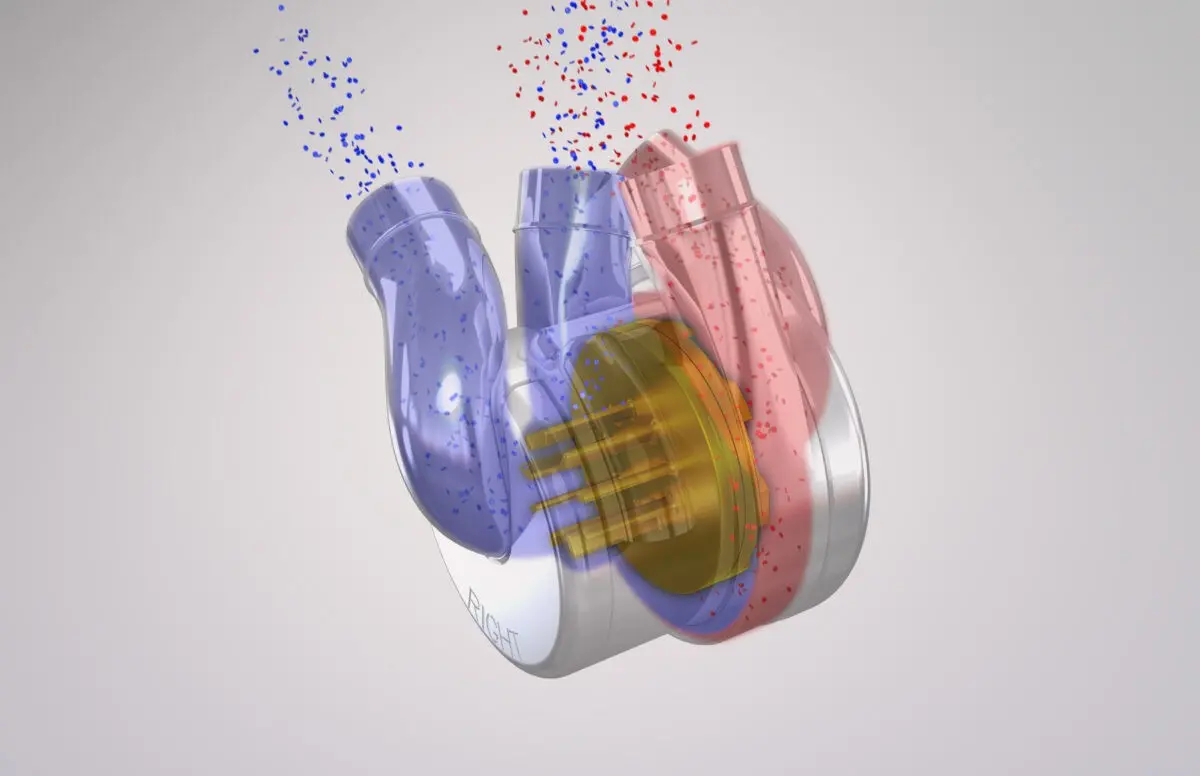 New Hope for Advanced Heart Failure: The Total Artificial Heart By Thomas A. Vassiliades, MD MBA 1 BiVACOR_4