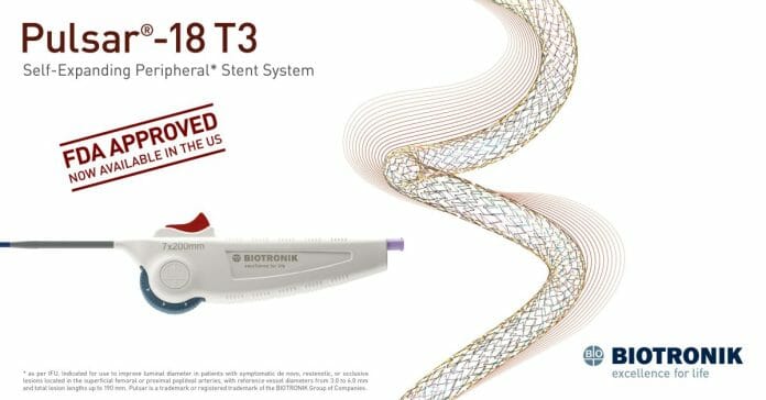 First and Only Peripheral Tri-axial 4-French Low-Profile Self-Expanding Stent System Receives FDA Approval