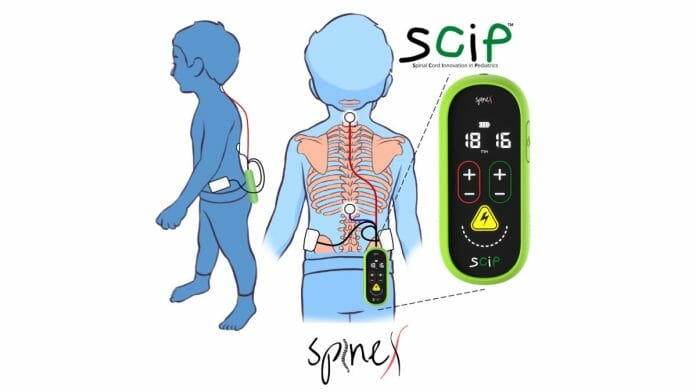 SpineX Demonstrates Groundbreaking Technology to Treat Children with Cerebral Palsy