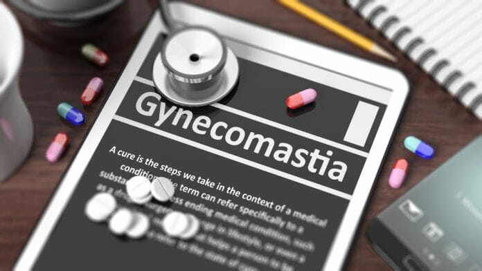 4 Things To Know About Gynecomastia