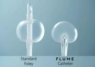 FLUME Catheter