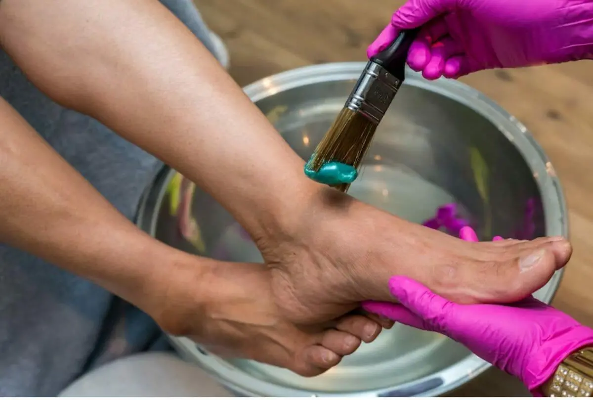 Sprained Ankle? Here’s What to Do to Relieve Pain and Discomfort 1 Injured Ankle