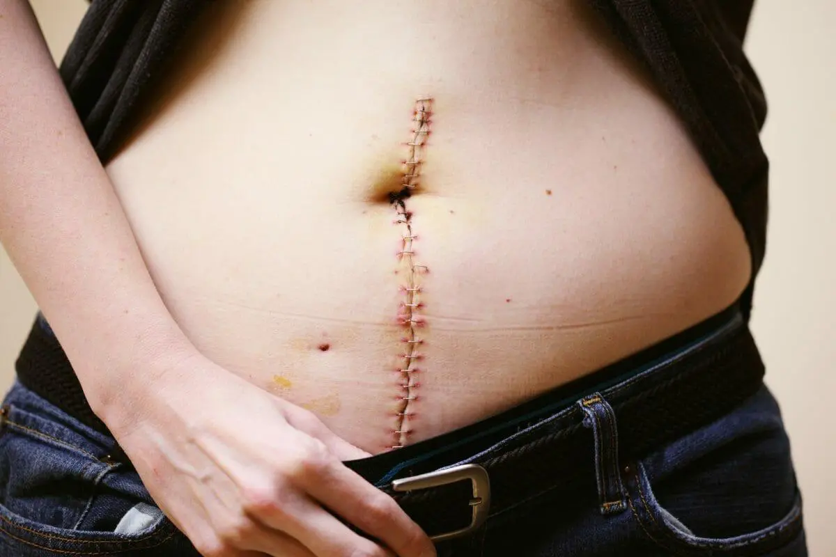 How To Take Better Care Of The Scars On Your Body 1 Scars On Your Body