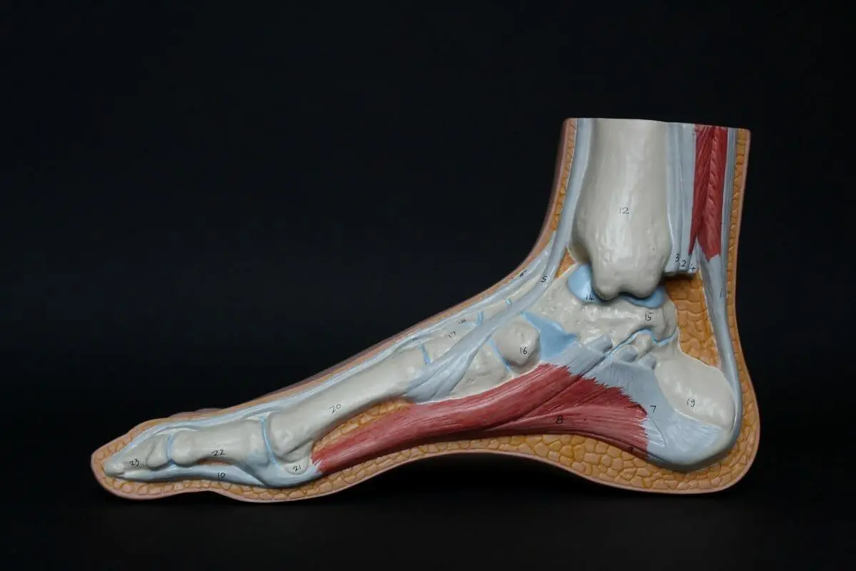 Home Remedies To End Your Ordeal With Plantar Fasciitis 1 Plantar Fasciitis