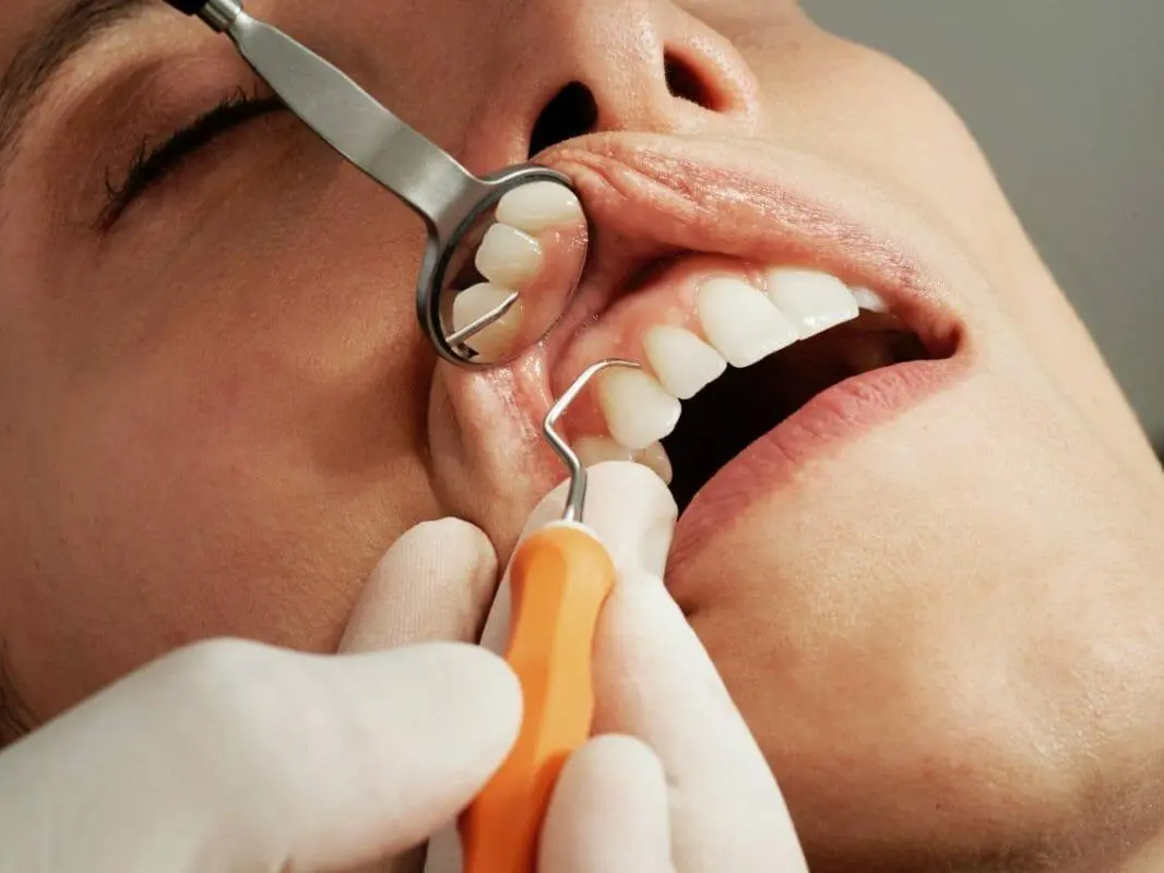 Discover the Foods That Can Naturally Strengthen Your Teeth 8 Strengthen Your Teeth can help Strengthen Your Teeth