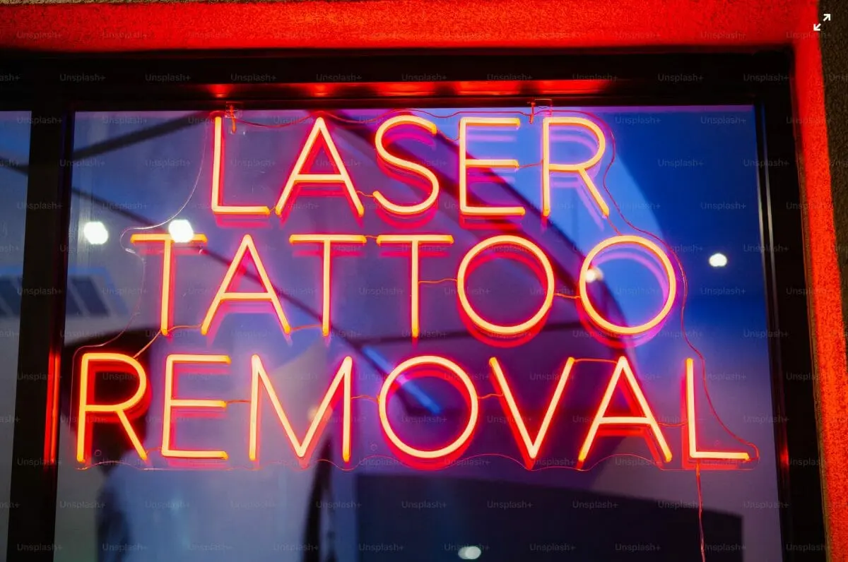 Vanishing Ink: Unveiling the Power and Precision of Tattoo Removal Machines 1 Tattoo Removal Machines