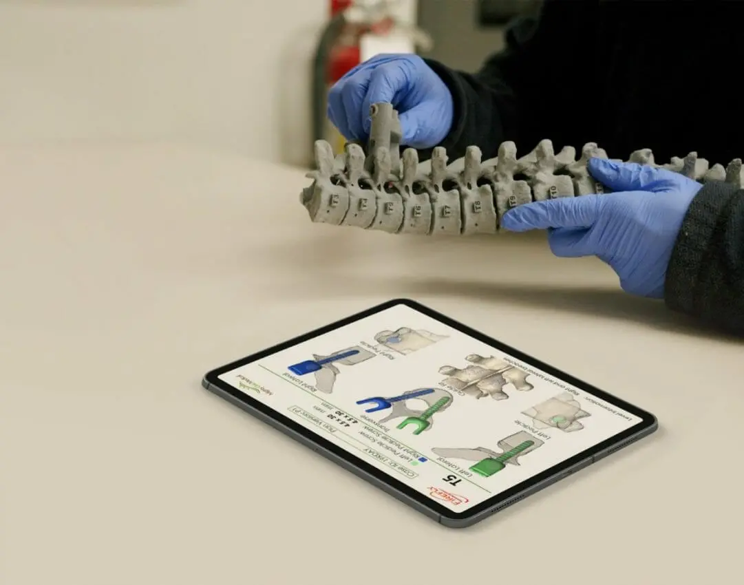 Why 3D Printers Are Ready to Transform Medical Device Design and Delivery | By Francois Minec, Global Head of 3D Polymers, HP Personalization & 3D Printing 4 Mighty Oak FIREFLY