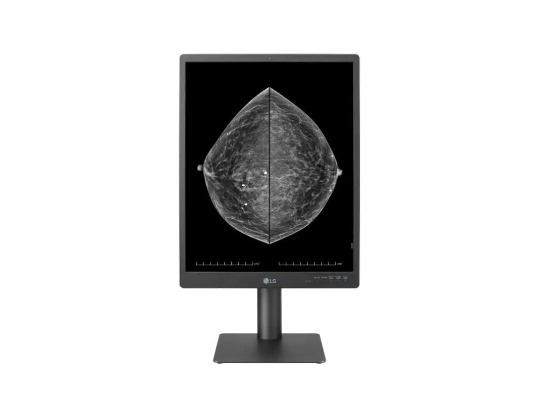 LG Reviewed 21-Inch Diagnostic Monitor Amid Full Display Line Showcasedat RSNA 2023 1 LG