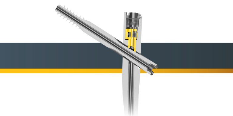 Stryker Reports: 1st European Surgeries Completed Using Stryker’s Gamma4 Hip Fracture Nailing System