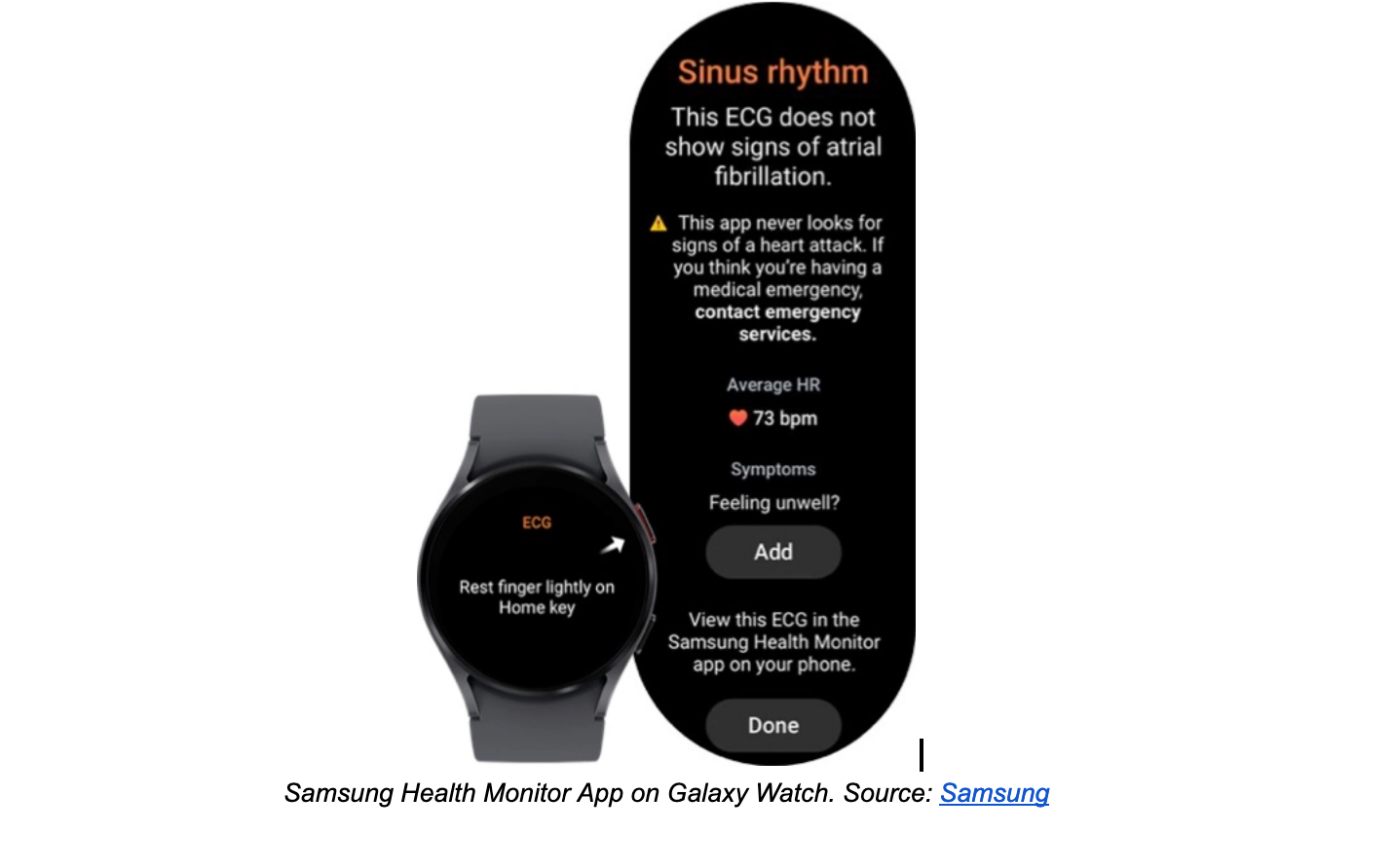 Samsung Health Monitor App on Galaxy Watch. 