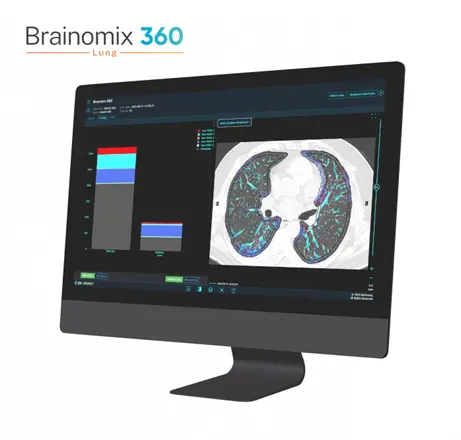 Brainomix and Boehringer Ingelheim Launch Strategic Partnership in Fibrosing Lung Disease 1 Brainomix