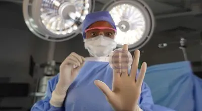 Umbilical hernia repair mesh