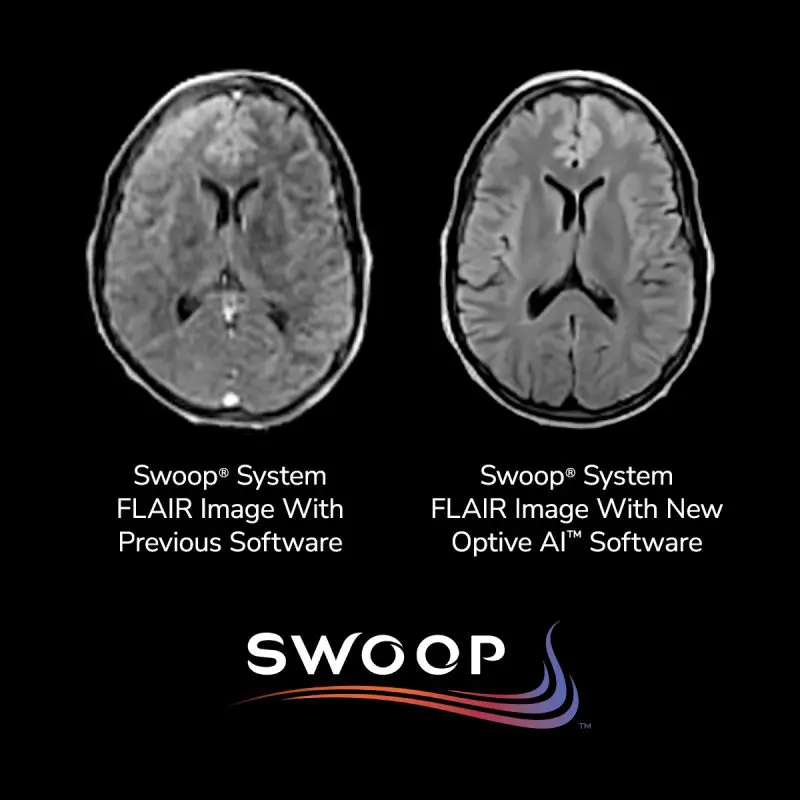 Swoop® System