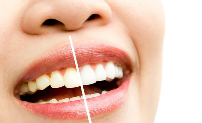 Bleach-Infiniter in Chicago