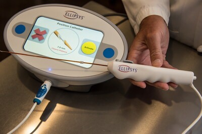 Ellipsys Vascular Access System to Return to U.S. Market in 2026