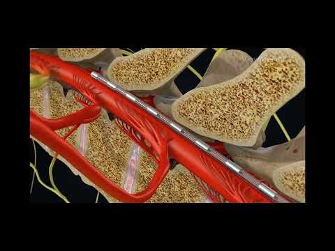 BIOTRONIK Neuro