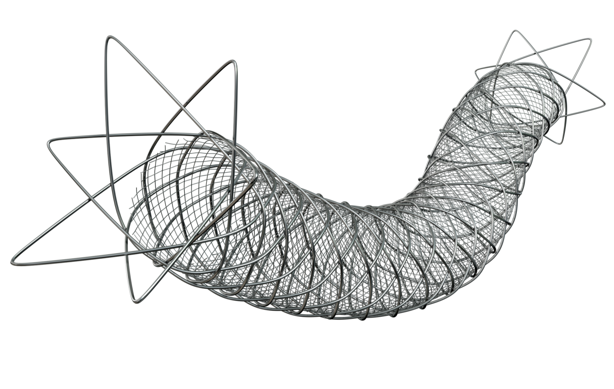 Terumo’s ROADSAVER™ Carotid Stent System: Leading the Evolution of Carotid Artery Stenting | By Tim Hoeman, Vice President, Marketing, Terumo Interventional Systems 1 ROADSAVER™ Carotid Stent System