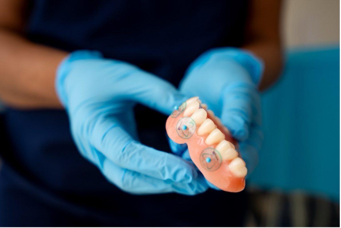 dental implants