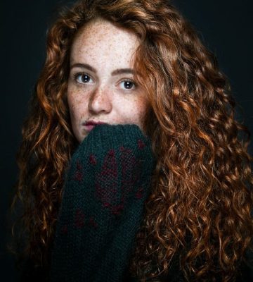 Melasma - A Guide to Treatment Methods